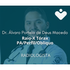 Raio-X Tórax PA/Perfil/Obliquo - RADIOLOGISTA - Dr. Álvaro Portela de Deus Macedo