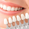 Facetas (lentes em porcelana) - Valor de cada dente
