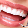Fechamento de Diastema com resina (espacinho entre dois dentes). valor para cada fechamento.