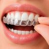 Ortodontia - Invisalign