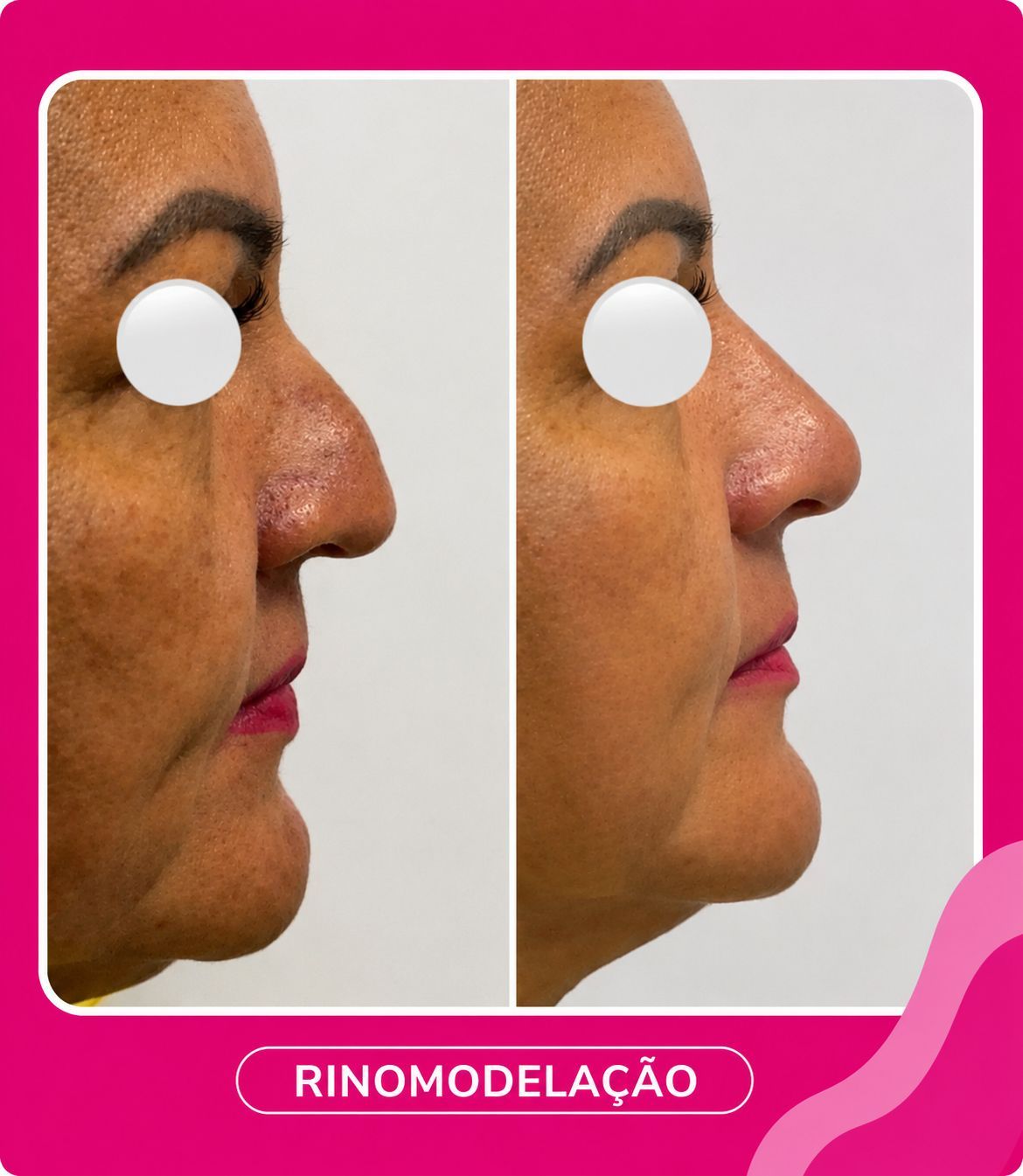 Rino-modelação 