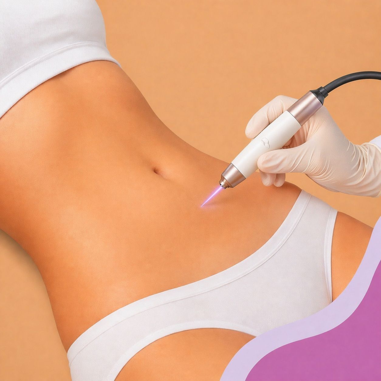 Jato de Plasma - 4 sessões para flacidez corporal (cada região)